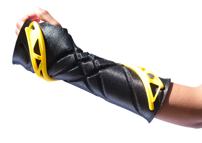 SCAP- ARTRO Handprotese an Hand und Unterarm