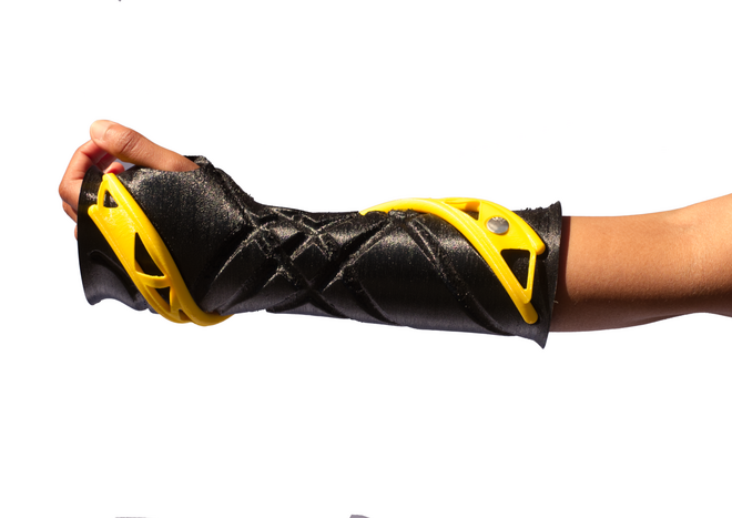 SCAP- ARTRO Handprotese an Hand und Unterarm