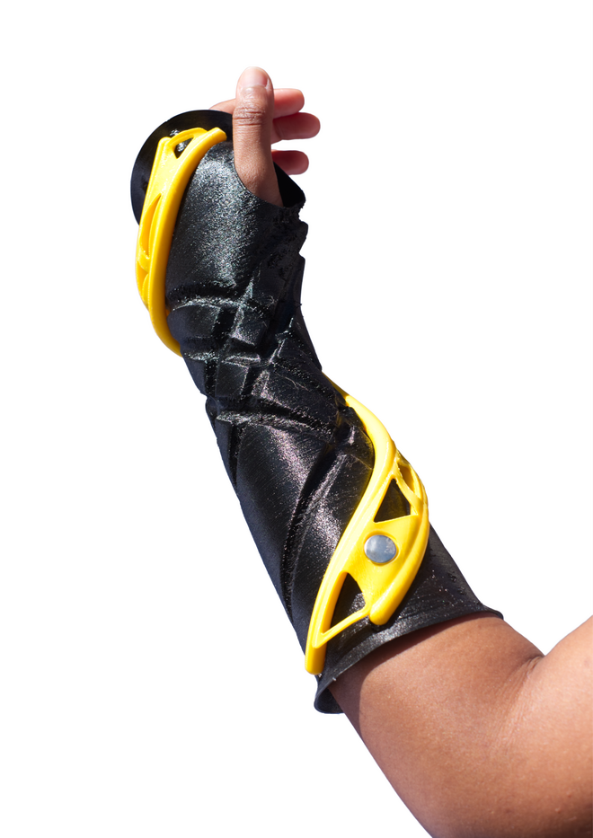 SCAP- ARTRO Handprotese an Hand und Unterarm