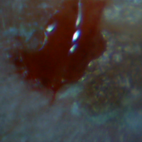 File:Blood Mikroskop.jpg