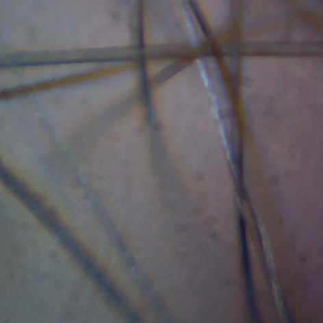File:Hairs Mikroskop.jpg