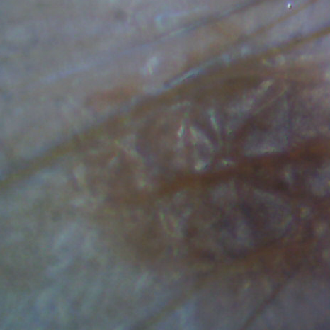 File:Mole Mikroskop.jpg