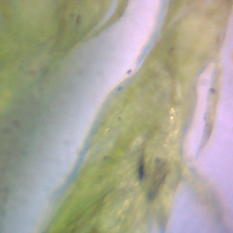 File:Moss 2 Mikroskop.jpg