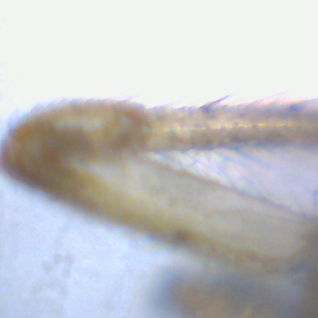 File:Spider leg Mikroskop.jpg