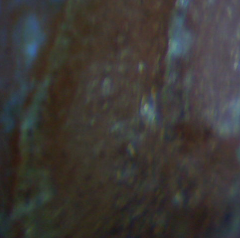 File:Wound Mikroskop.jpg
