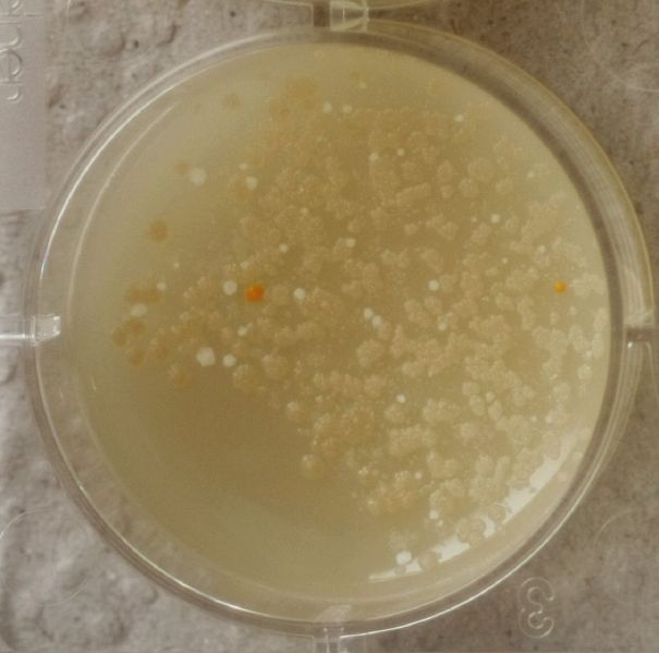 File:1-1 Gluconacetobacter xylinus.jpg