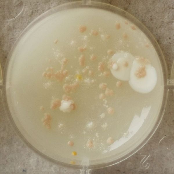 File:1-6 Gluconacetobacter xylinus.jpg