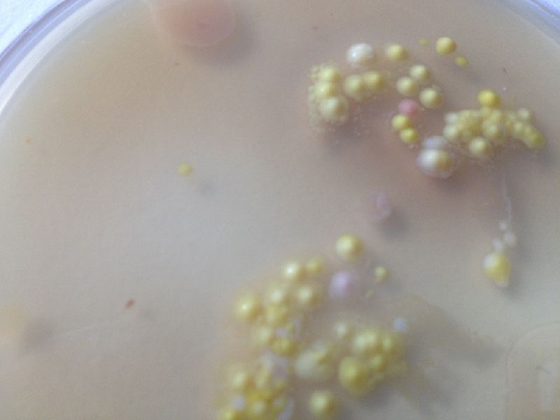 File:Agar Imprint Right Finger Neutral.jpg