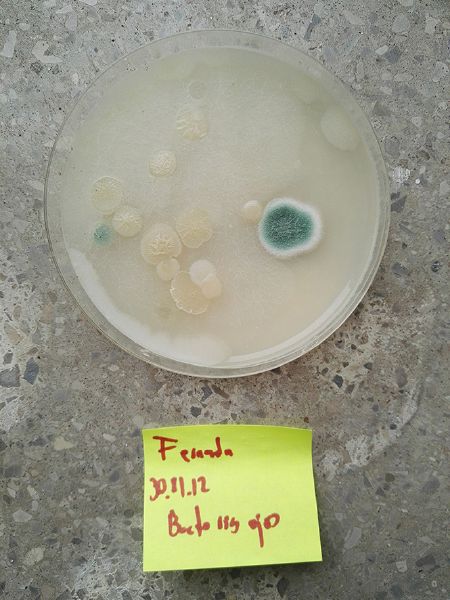 File:Bacteria Eyes.jpeg