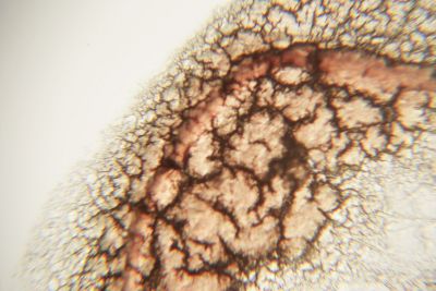 Blood contaminated analysis1.JPG