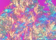 Bone Gout MSUCrystals JointFluid resized.jpg