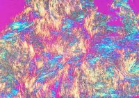 Bone Gout MSUCrystals JointFluid resized.jpg