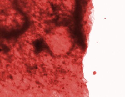 De human blood.jpg