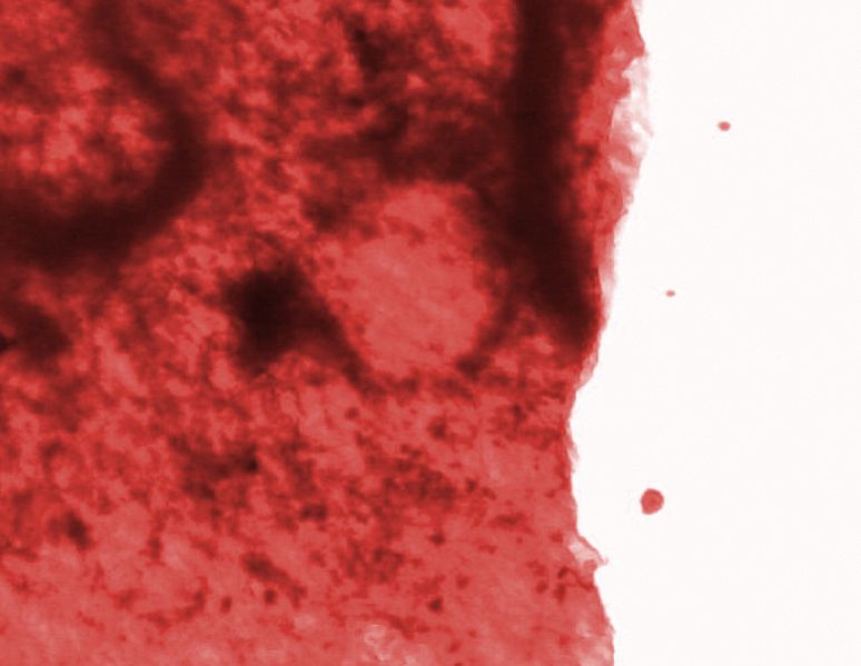 File:De human blood.jpg