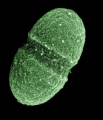 Enterococcus faecalis bacterium, which lives in the human gut. Source: wikipedia