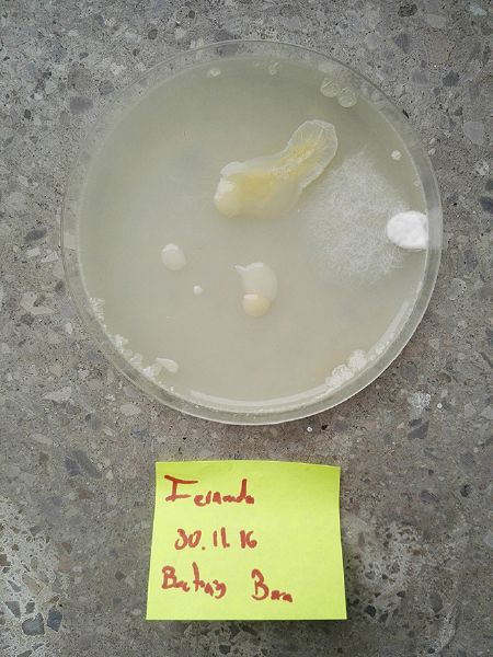 File:Face Bacteria.jpeg