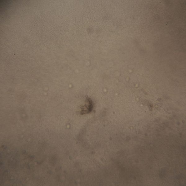 File:Gluconacetobacter 400 times magnification.jpg