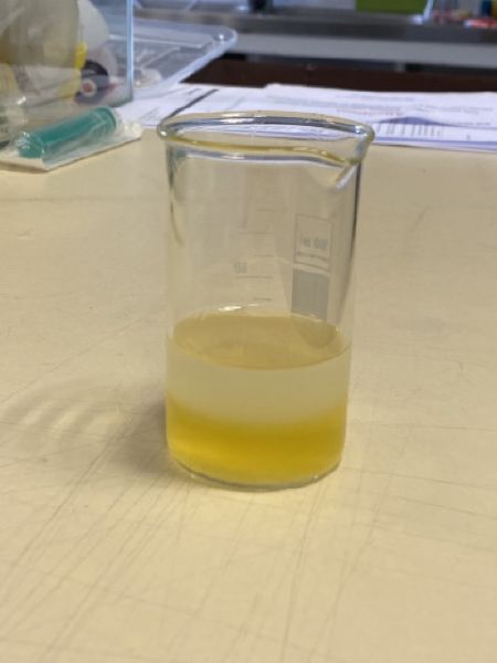File:Kaki gelElectrophoresis 7.jpeg