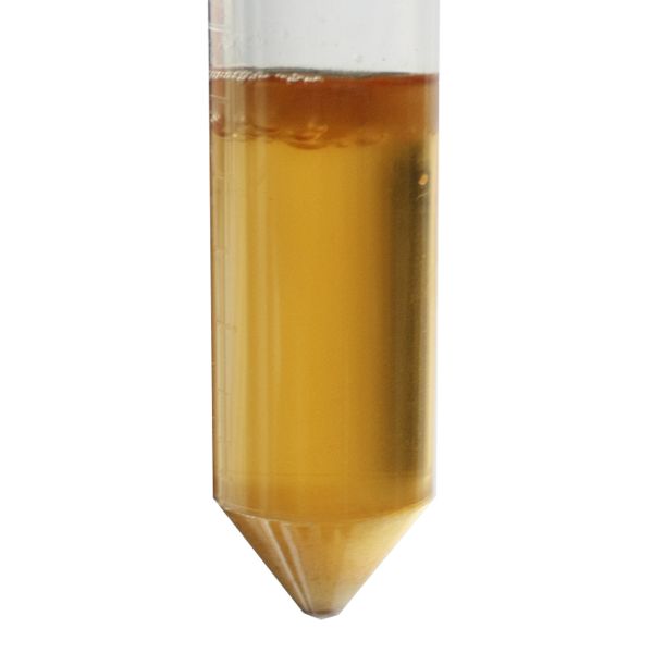 File:Kombucha recombination 3.jpg