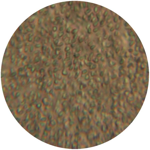 File:LACTOBACILLUS 3-c.jpg