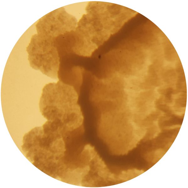 File:LACTOCOCCUS 2-d.jpg