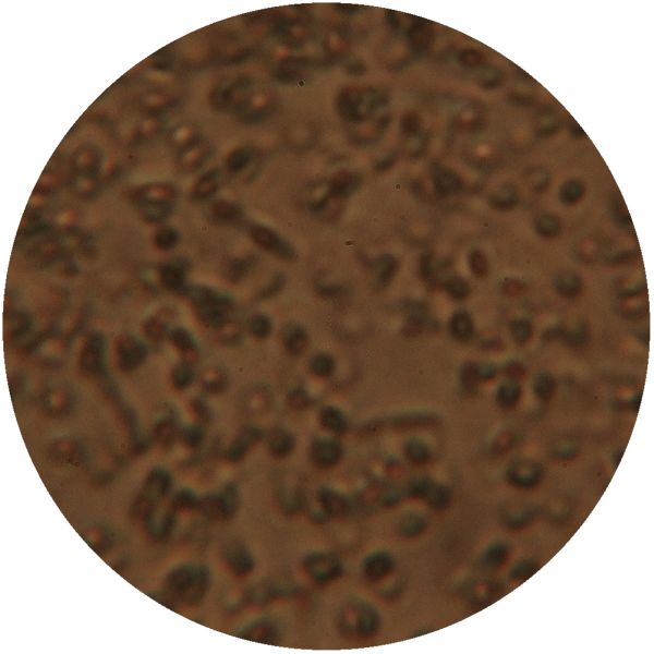 File:LACTOCOCCUS 3-c.jpg