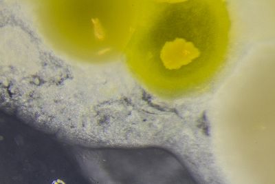 Macrophoto bacteria 3.jpg