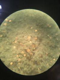 Nose microbiota sample