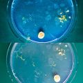 Plasmodium 2nd day vs. 3rd day