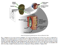 Retina-implant.png