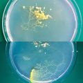 Plasmodium 2 2nd day vs. 3rd day