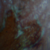Wound 2 Mikroskop.jpg