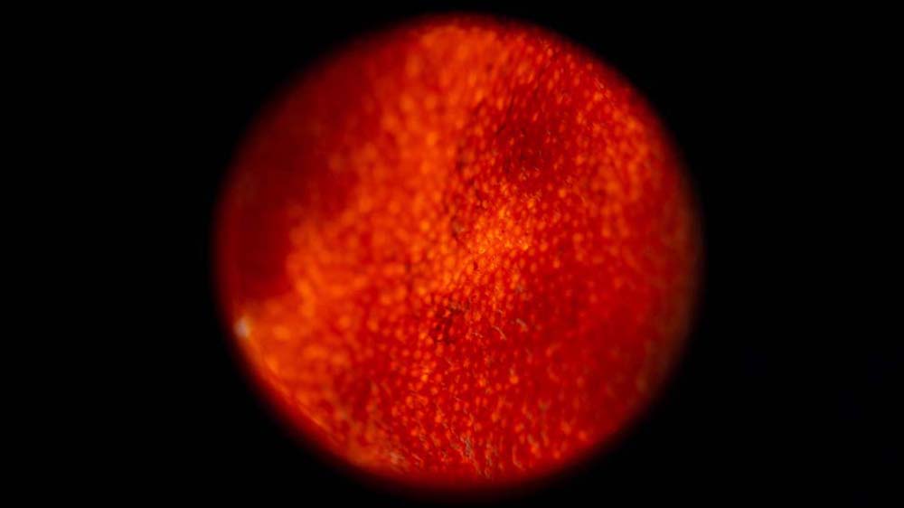 © Murandu; Schröder